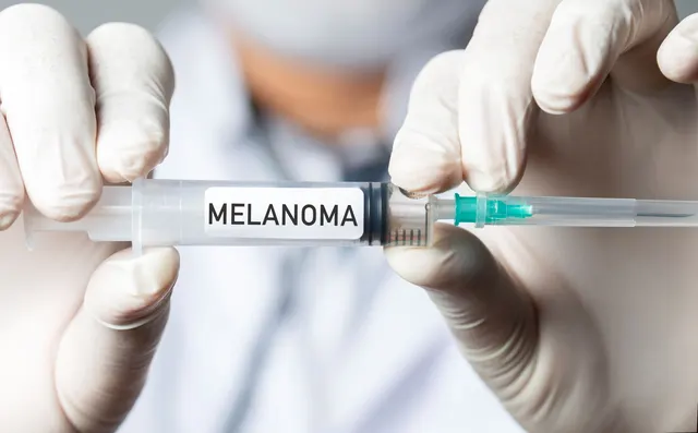 New mRNA Vaccine Reduces Risk of Melanoma Recurrence by Over 40 Percent